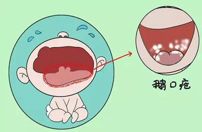Ӥڴô