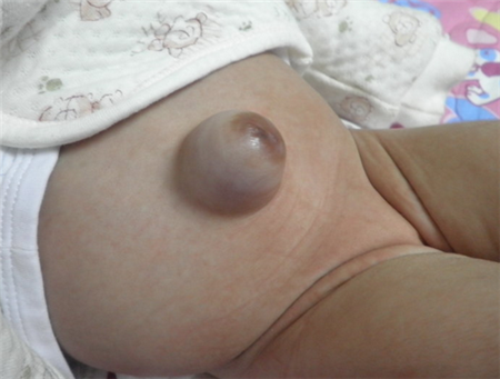 Ӥ޵ԭ